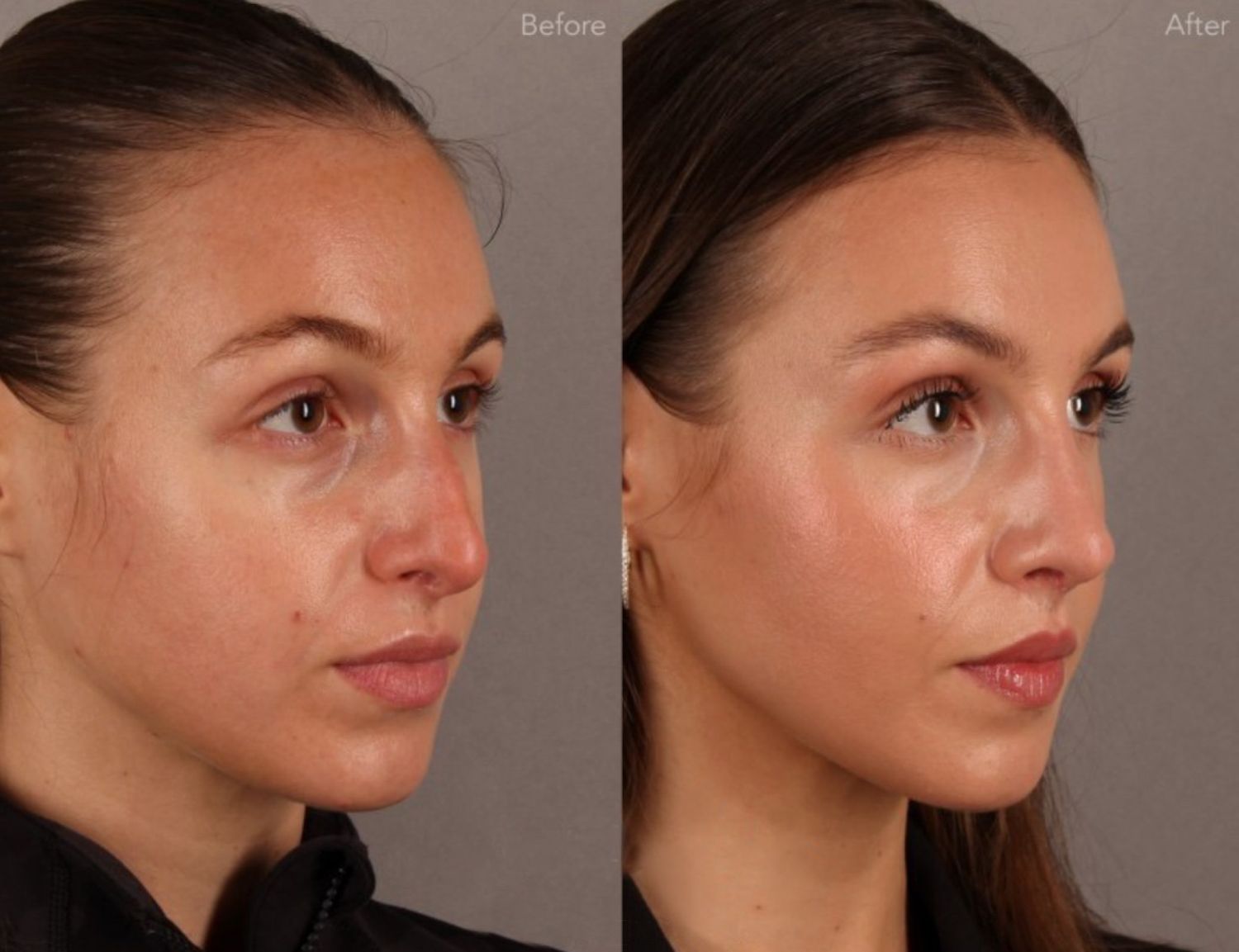 Dr. Jonathan Cabin before and afters