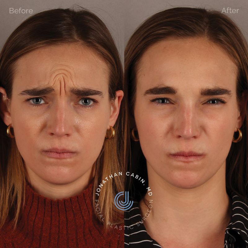 arlington facelift
