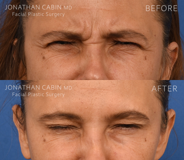 Jonathan Cabin Before and Afters