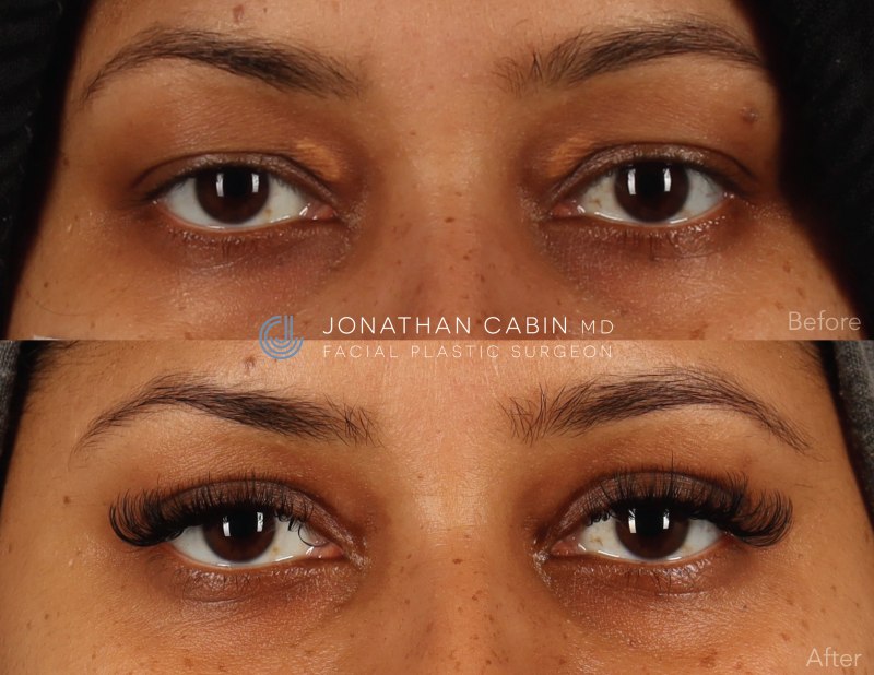 Jonathan Cabin Before and After