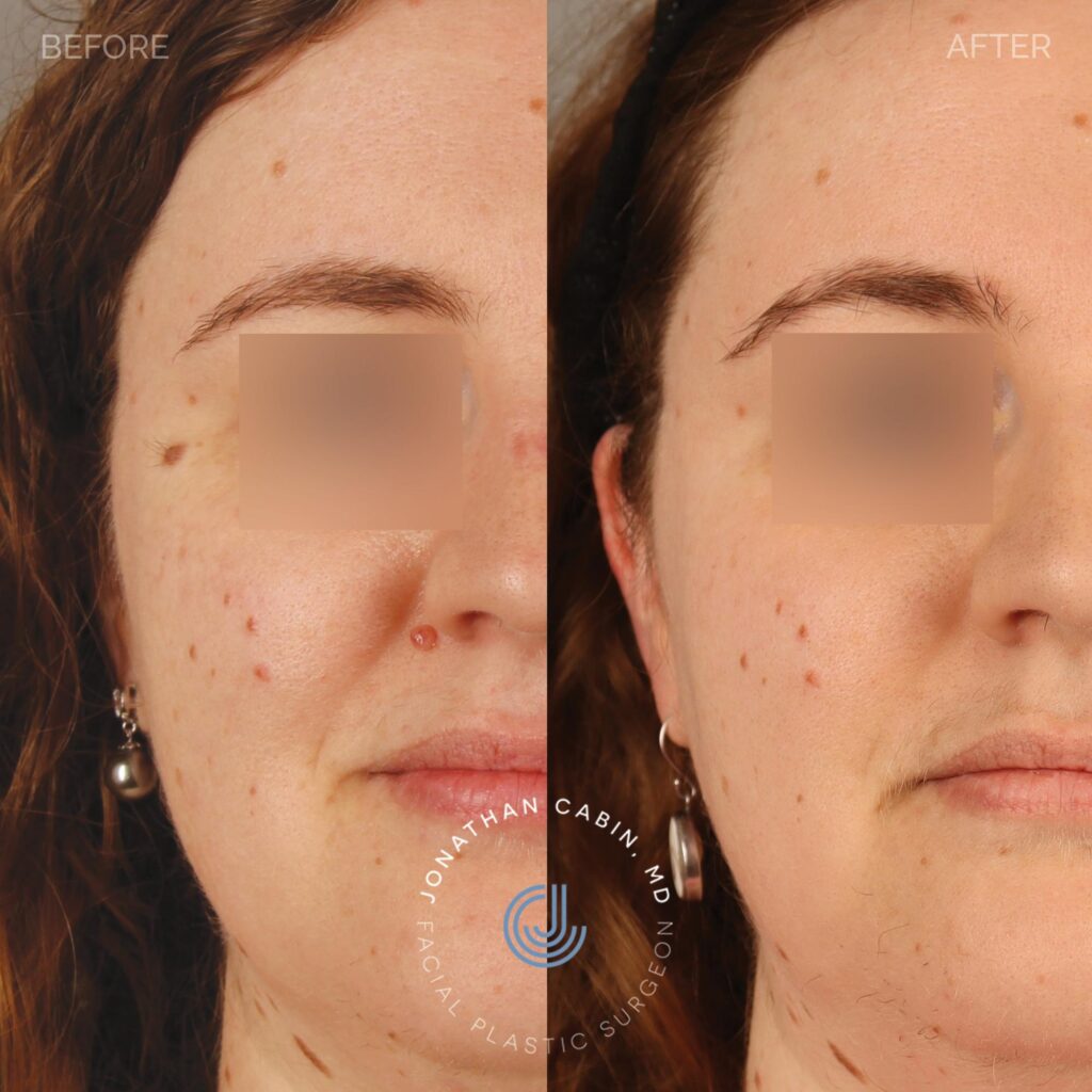 105 - KZ - Mole of Two Moles - non-identifying_10
